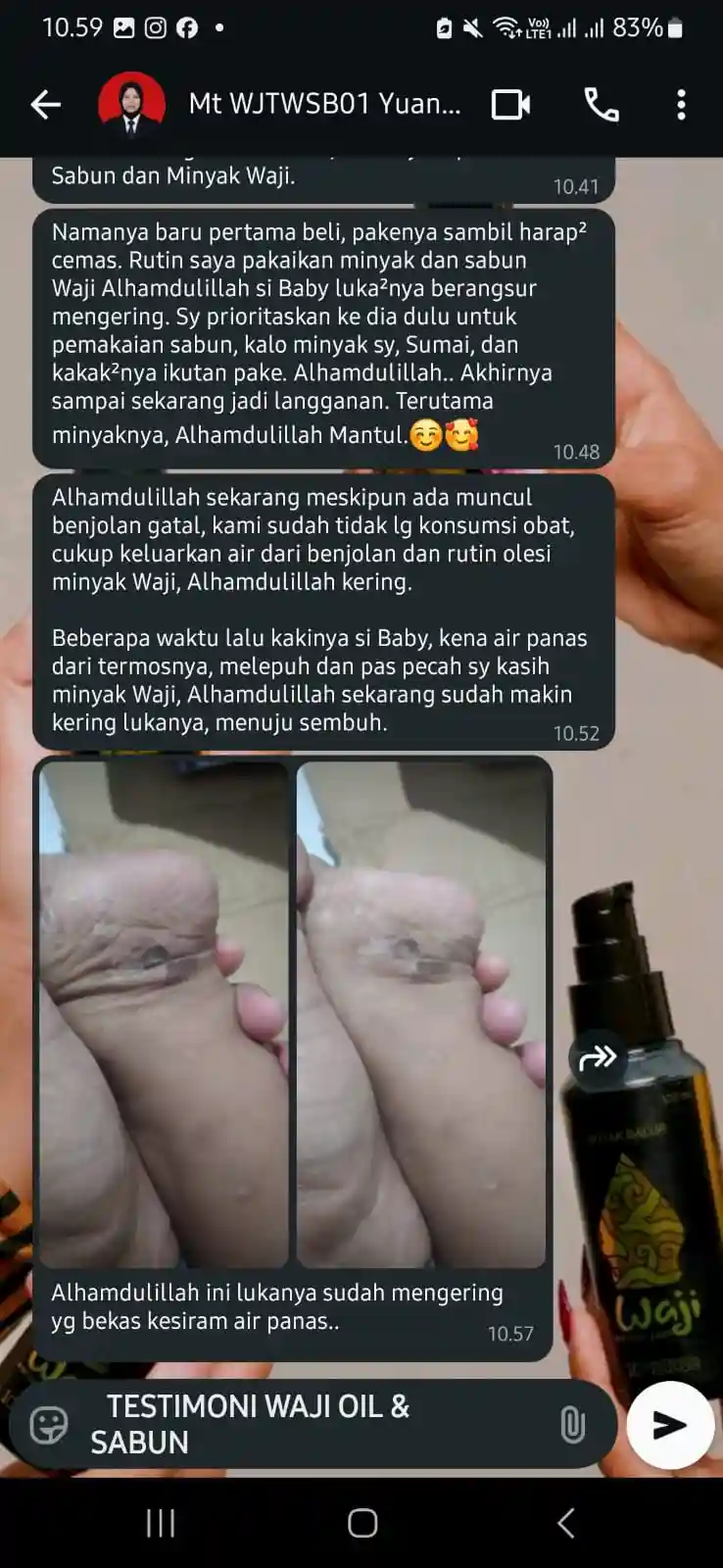 (MS) bayi benjolan gatal