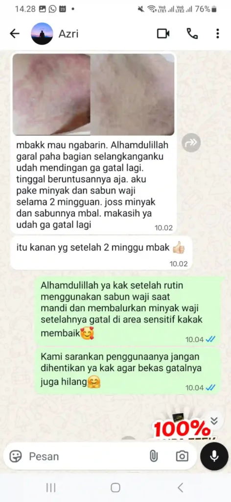(MS) selangkanngan