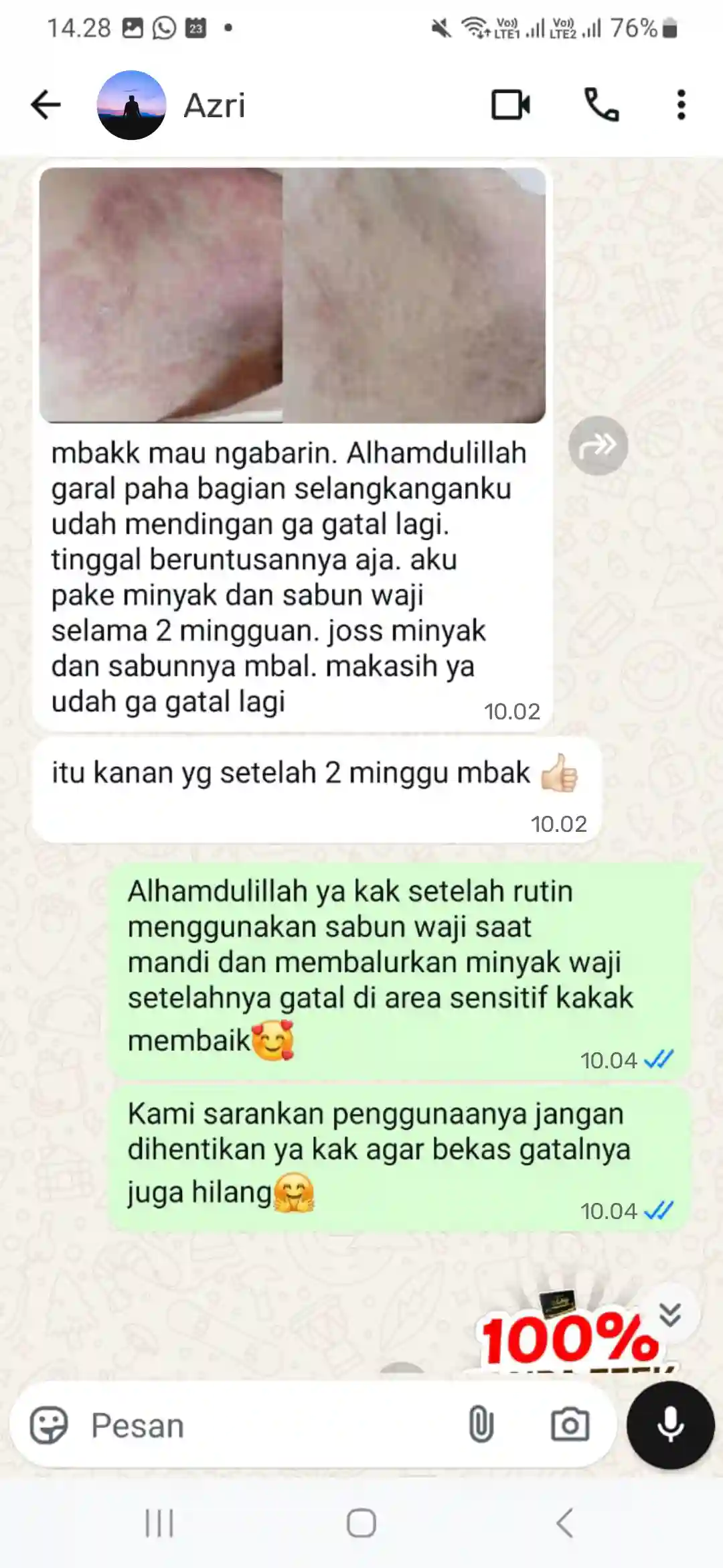 (MS) selangkanngan