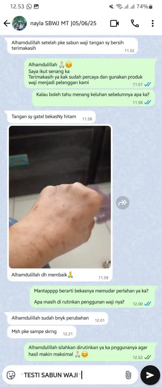 (S) BEKAS GATAL