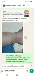 (S) GATAL DAN BEKAS1 (2)