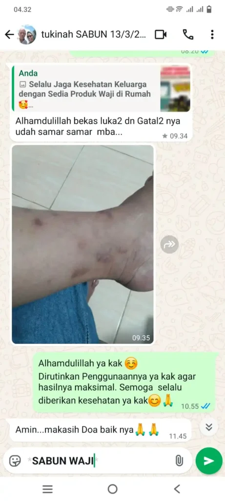 (S) GATAL DAN BEKAS1 (2)
